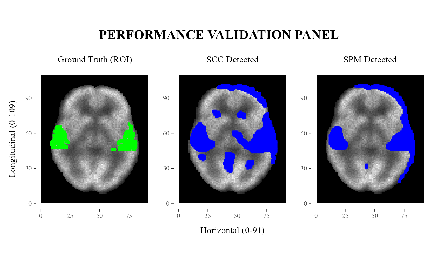 Validation panel comparing ROI, SCC, and SPM detections